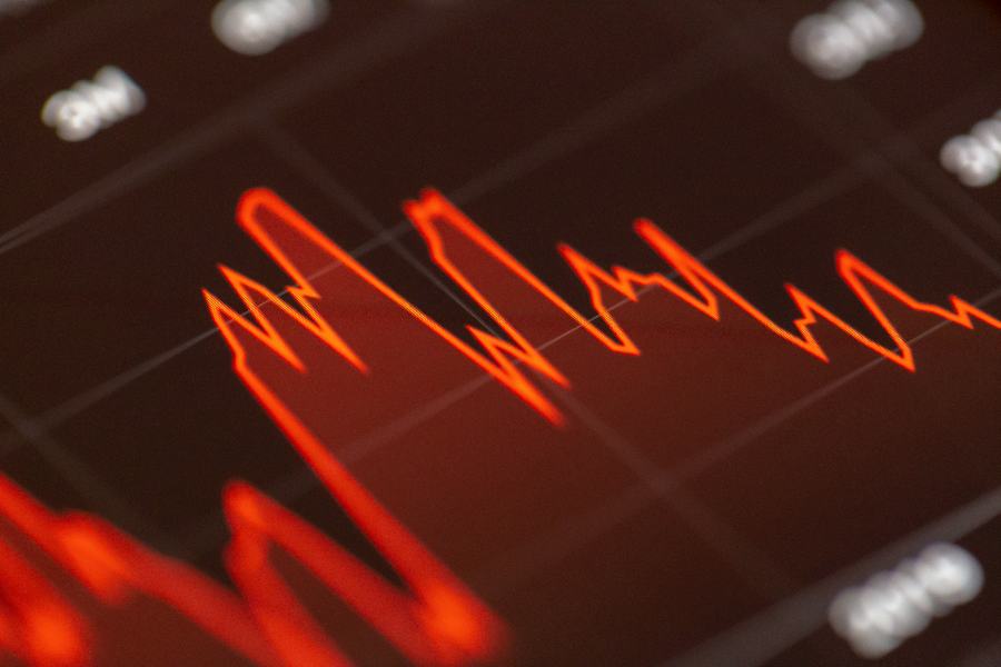 A price chart on a screen